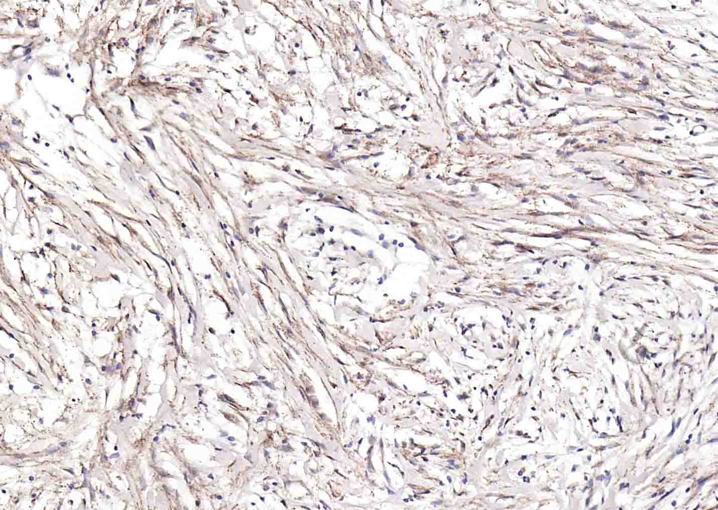 Anti-Collagen II/COL2A1 Antibody (7X334)