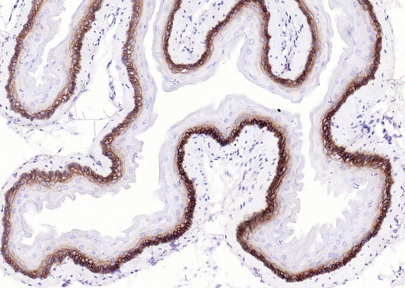 Anti-Collagen XVII/COL17A1 Antibody (3R637)