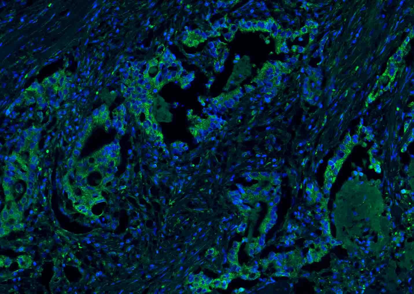 Anti-CEACAM5 Polyclonal Antibody 2