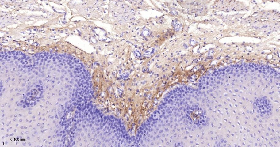 Anti-Collagen III/COL3A1 Polyclonal Antibody