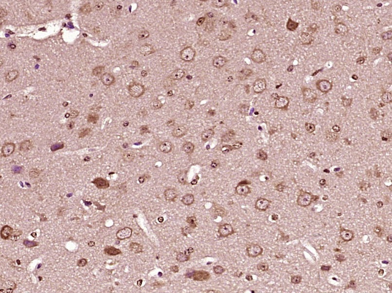 Anti-Collagen X/COL10A1 Polyclonal Antibody