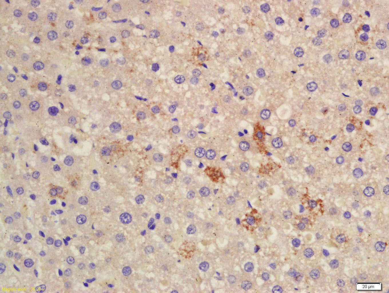 Anti-CES1 Polyclonal Antibody