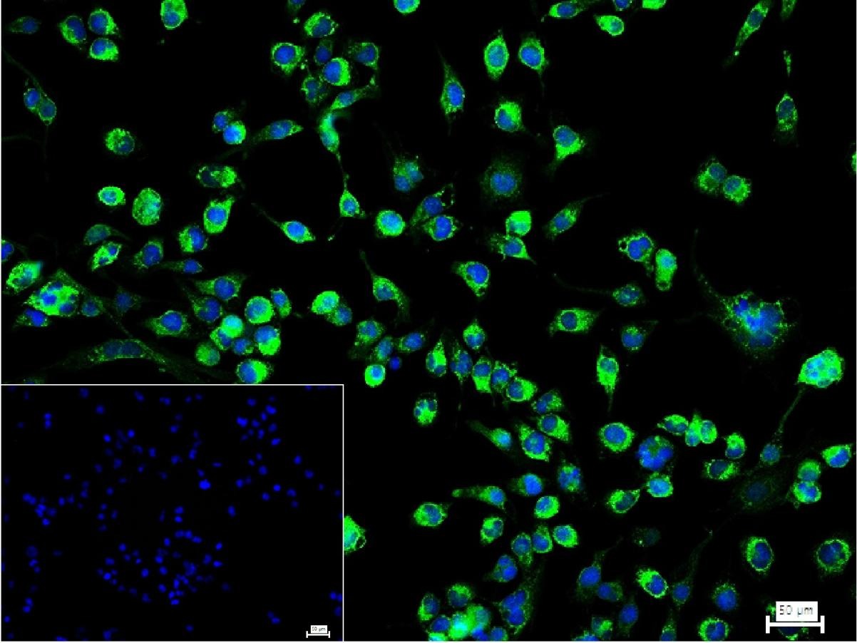 Anti-Collagen III/COL3A1 Polyclonal Antibody 2