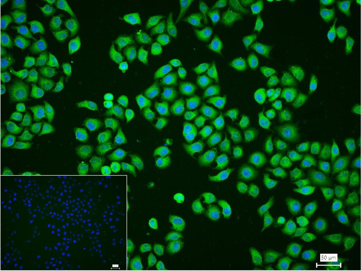 Anti-COX-2 Polyclonal Antibody 2