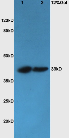 Anti-YKL-40/CHI3L1 Polyclonal Antibody 2