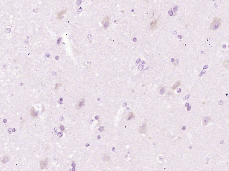 Anti-CH25H Polyclonal Antibody