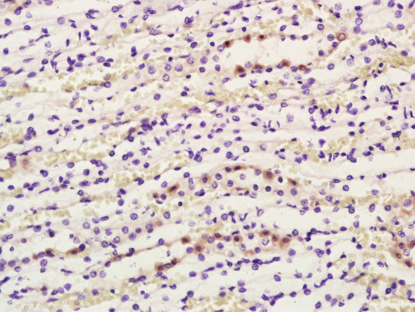 Anti-COX1/MTCO1 Polyclonal Antibody