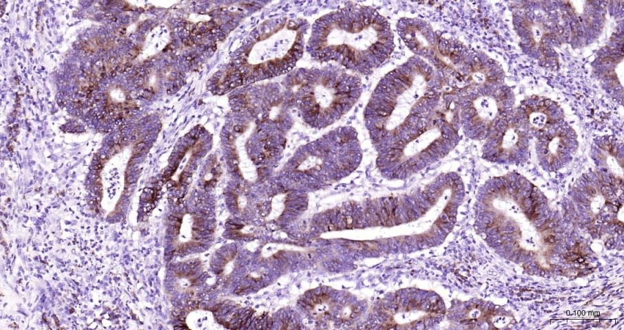 Anti-COX-2 Polyclonal Antibody