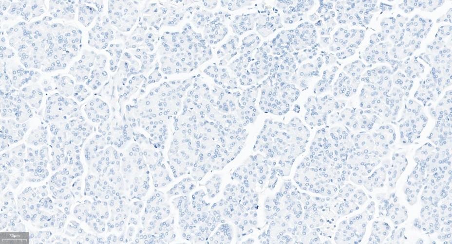 Anti-Chorionic Gonadotropin/CGA Antibody (3J474)