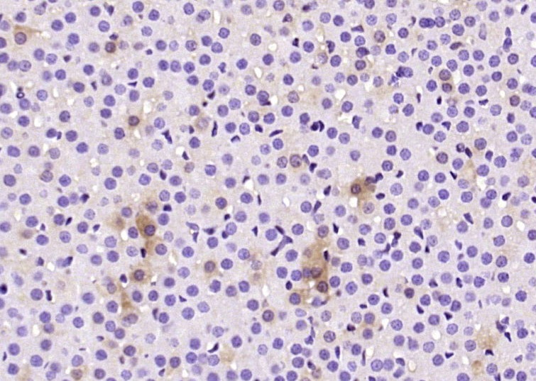 Anti-CHGA Polyclonal Antibody