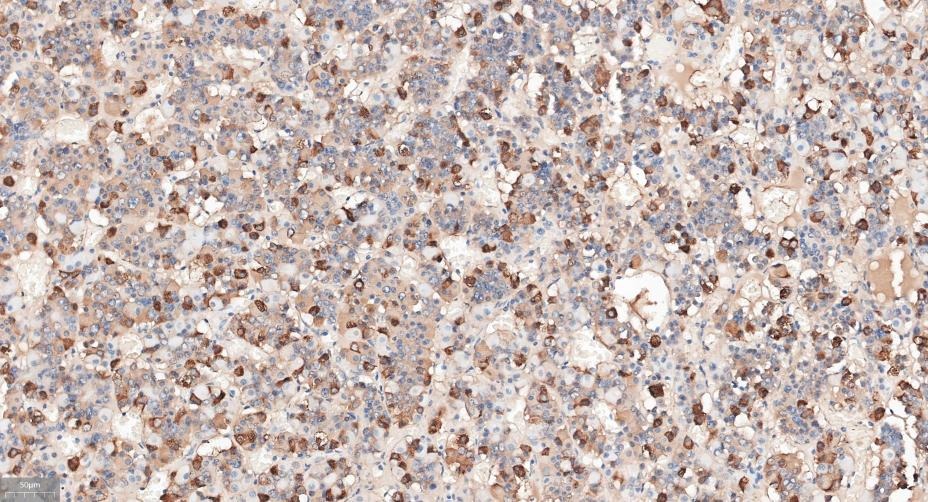Anti-Chorionic Gonadotropin/CGA Antibody (3J474)