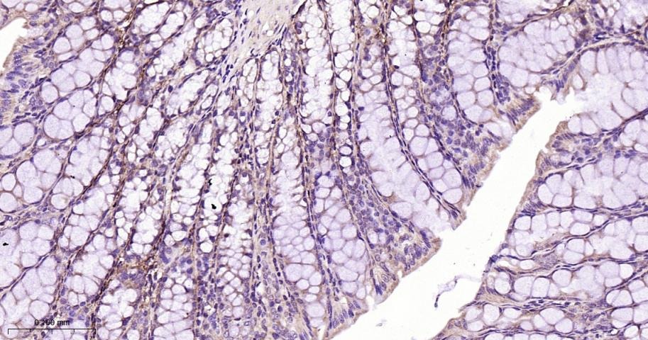 Anti-CPT1A Polyclonal Antibody