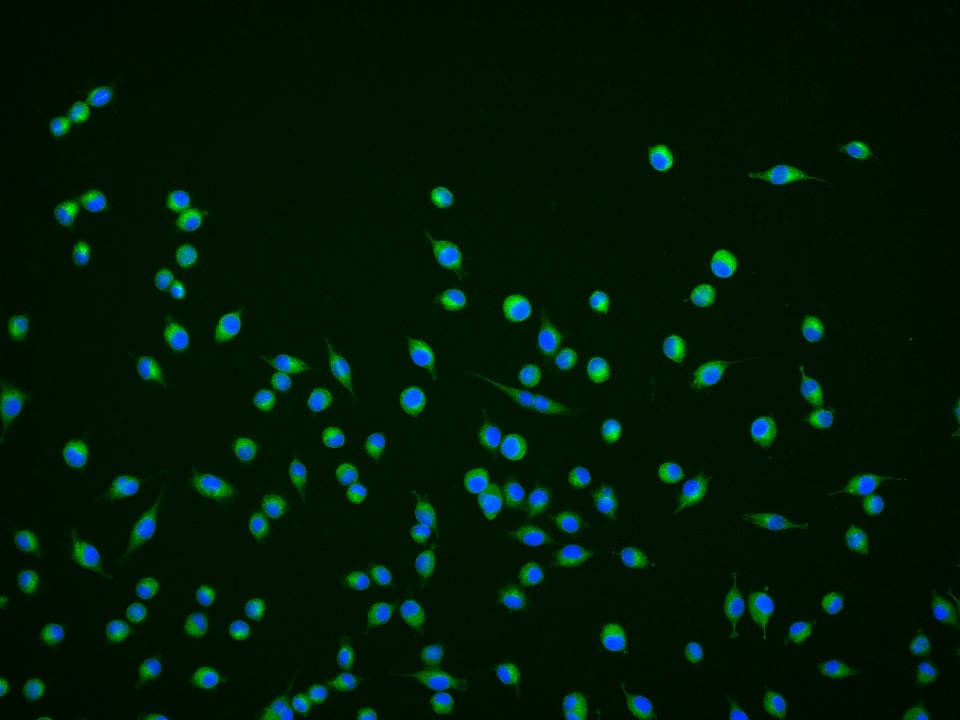 Anti-CHGA Polyclonal Antibody