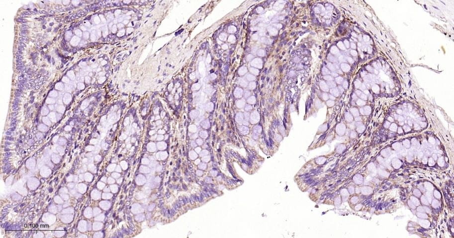 Anti-CPT1A Polyclonal Antibody