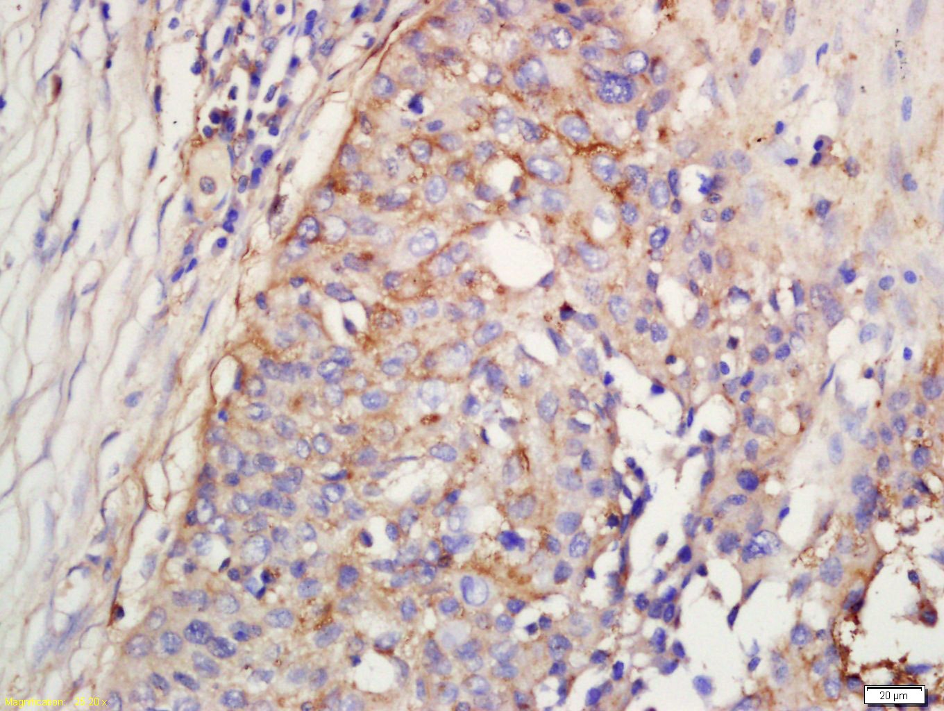 Anti-Complement Factor D/CFD Polyclonal Antibody