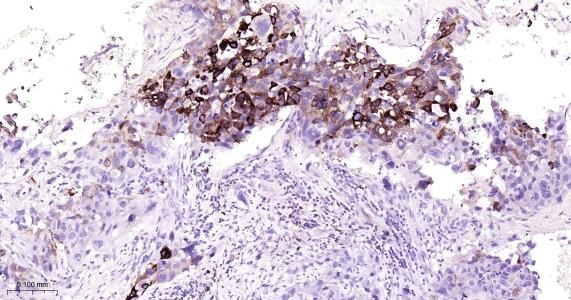Anti-COX-2 Antibody (1O260)