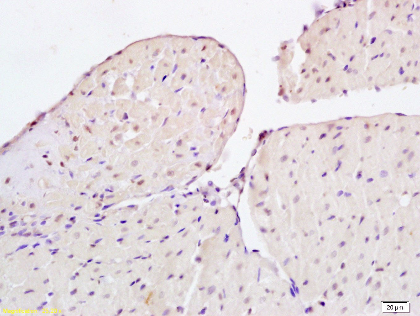 Anti-CIDEC Polyclonal Antibody