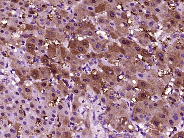 Anti-C-Reactive Polyclonal Antibody