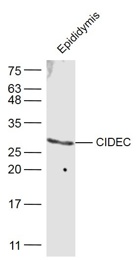 Anti-CIDEC Polyclonal Antibody