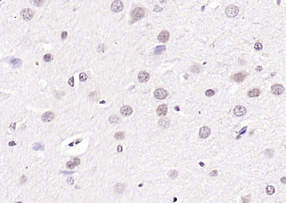 Anti-CIDEC Polyclonal Antibody