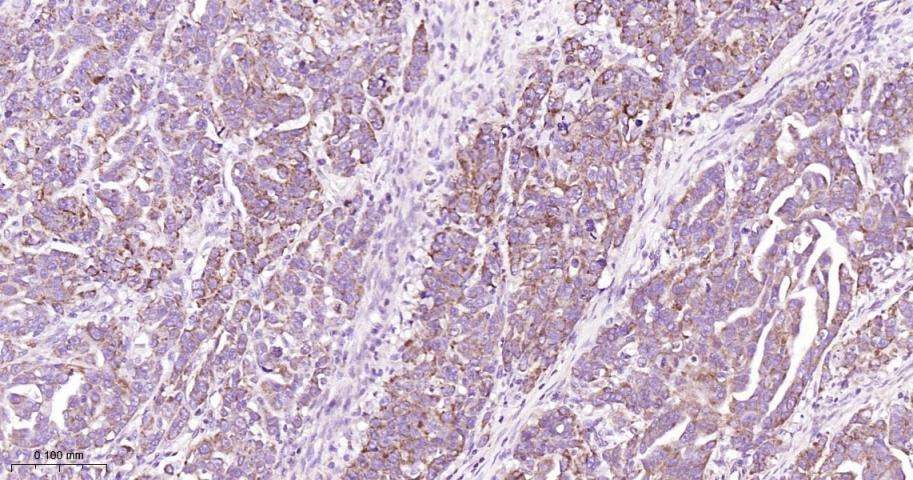 Anti-CPT1A Polyclonal Antibody