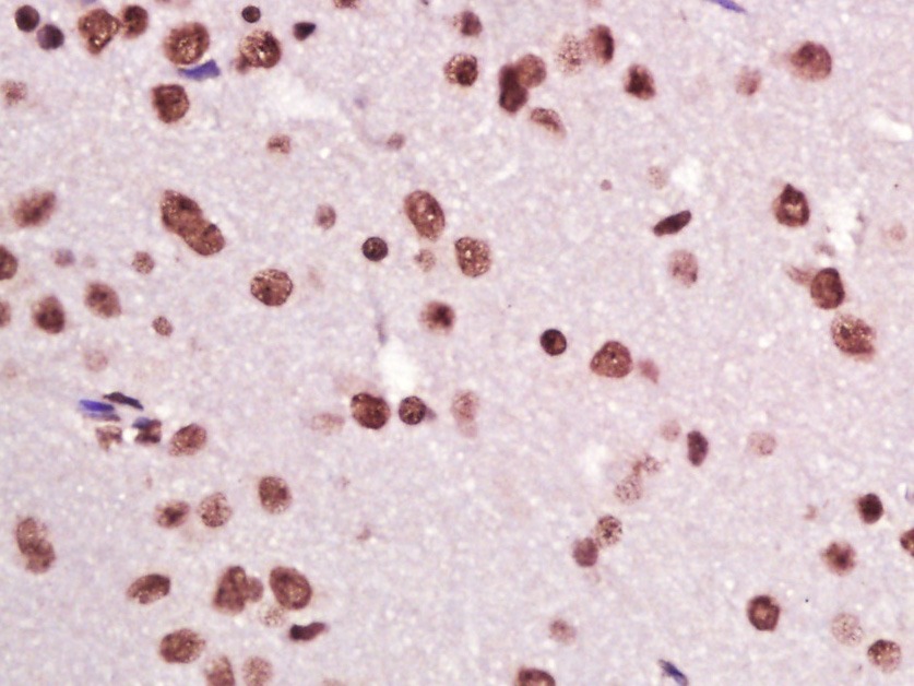 Anti-CIDEC Polyclonal Antibody