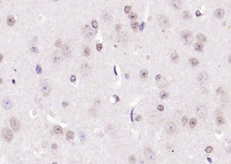 Anti-CIDEC Polyclonal Antibody