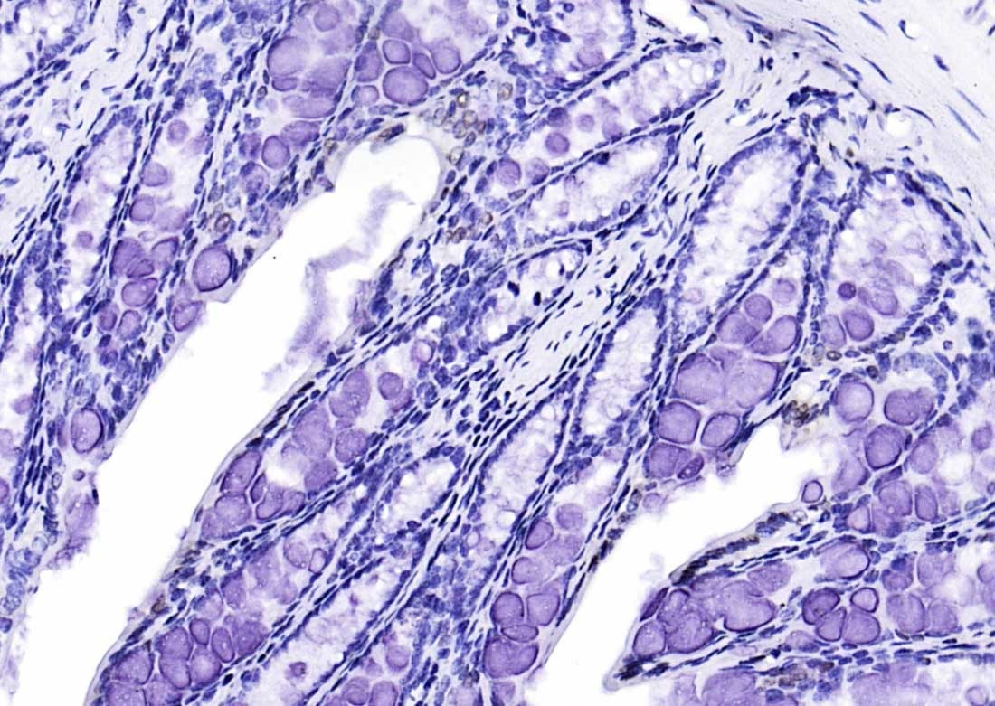 Anti-CIDEC Polyclonal Antibody