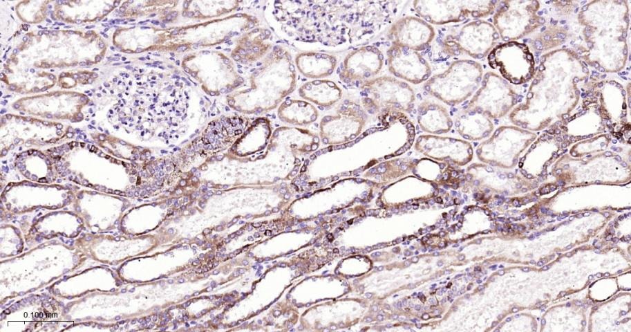 Anti-CPT1A Polyclonal Antibody
