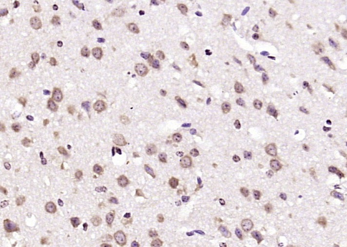 Anti-CHST2 Polyclonal Antibody