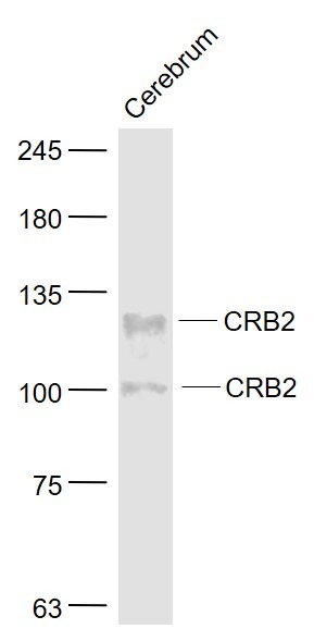 Anti-CRB2 Polyclonal Antibody