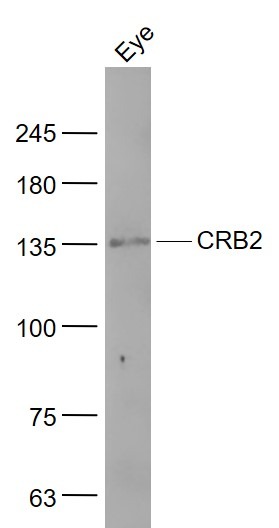 Anti-CRB2 Polyclonal Antibody
