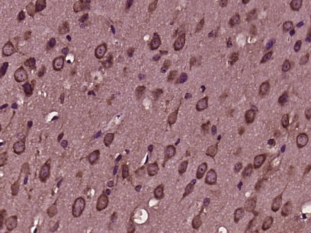 Anti-SQSTM1/P62 Polyclonal Antibody