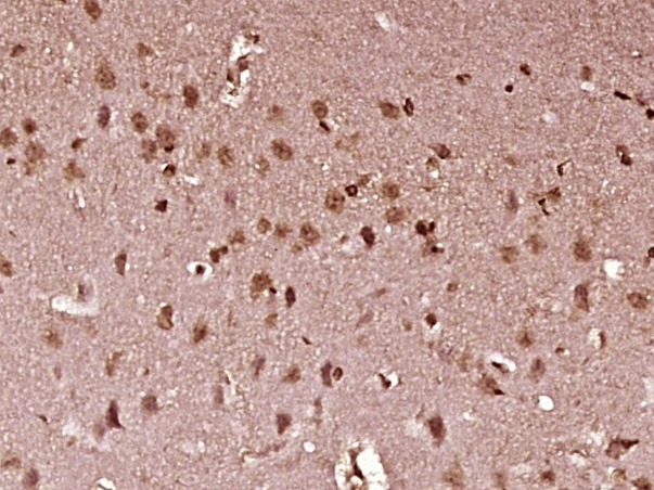 Anti-STAT1 Polyclonal Antibody 2