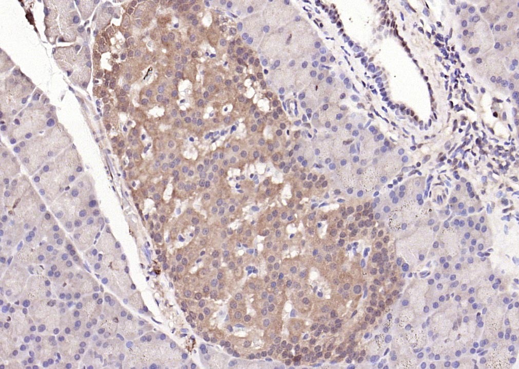 Anti-STAT3 Antibody (9V551)