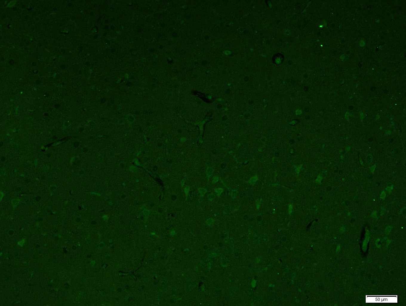Anti-Src Polyclonal Antibody