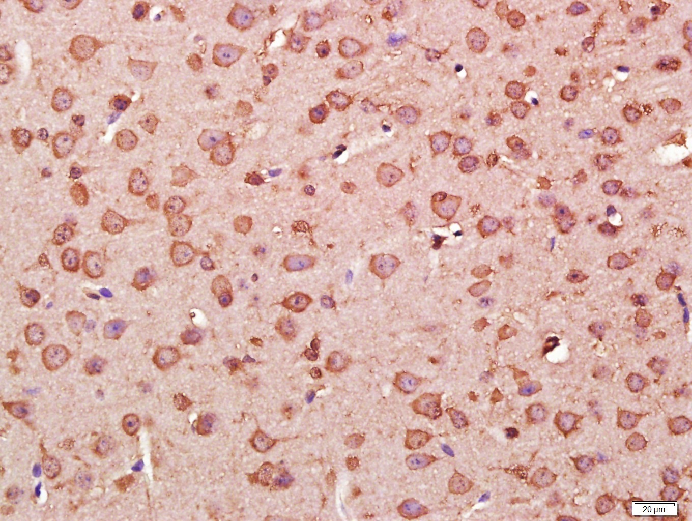 Anti-STAT3 Antibody (9V551)