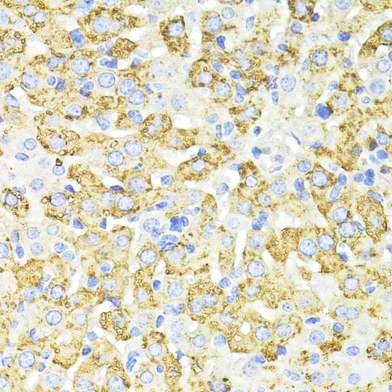 Anti-SQSTM1/p62 Polyclonal Antibody 2