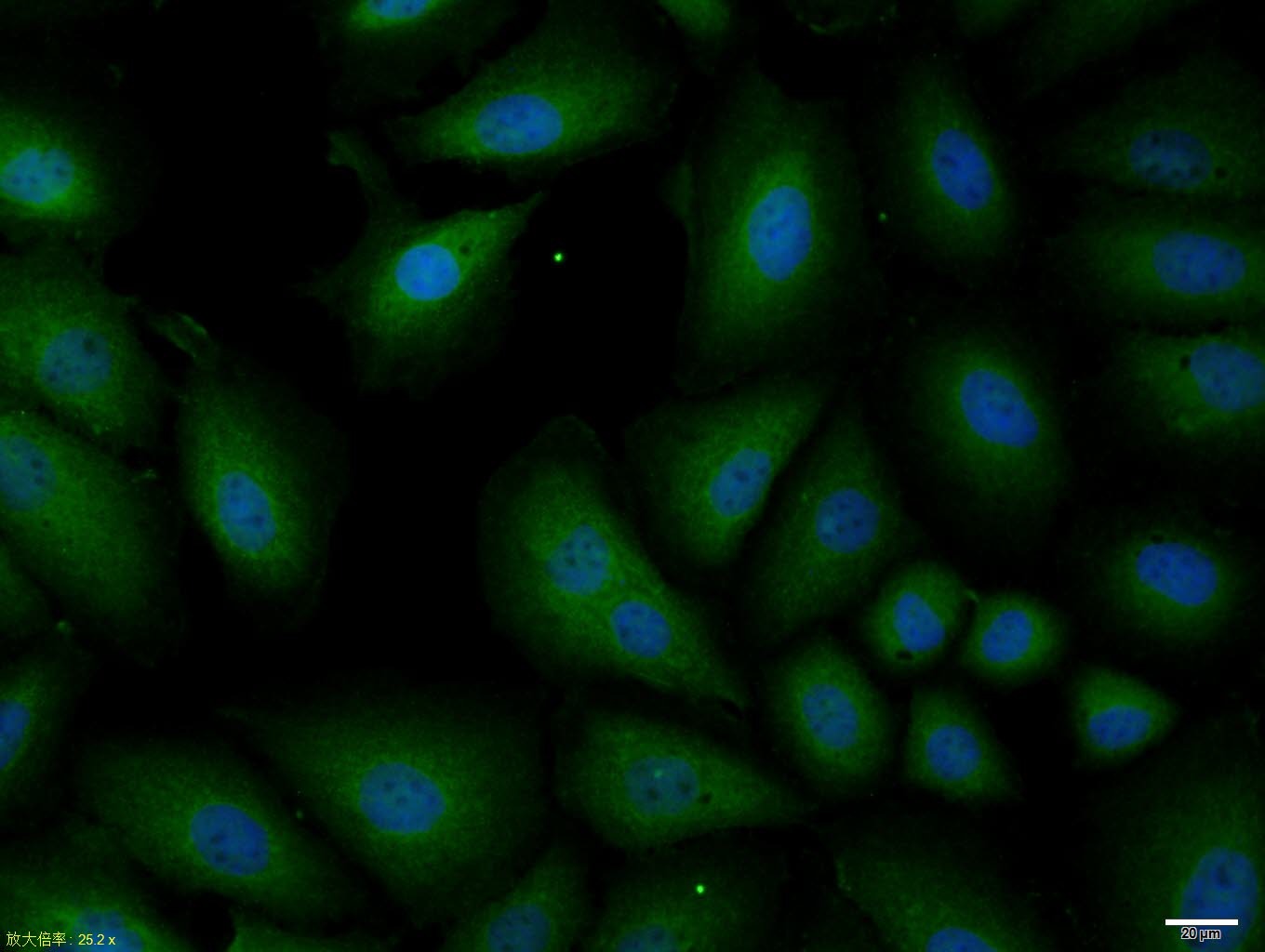 Anti-SQSTM1/P62 Polyclonal Antibody