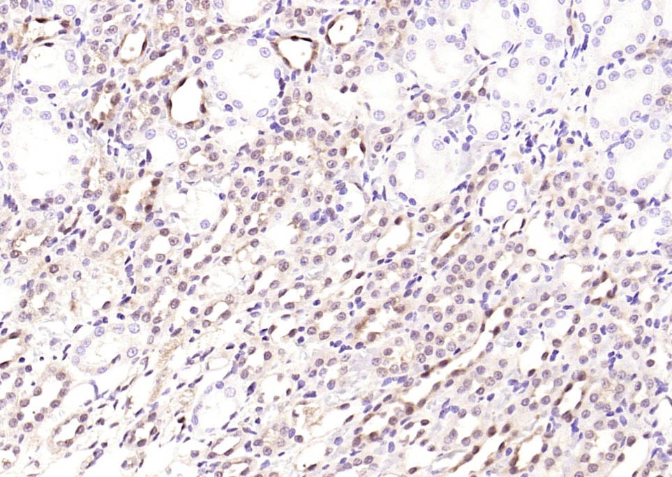 Anti-STAT3 Antibody (9V551)
