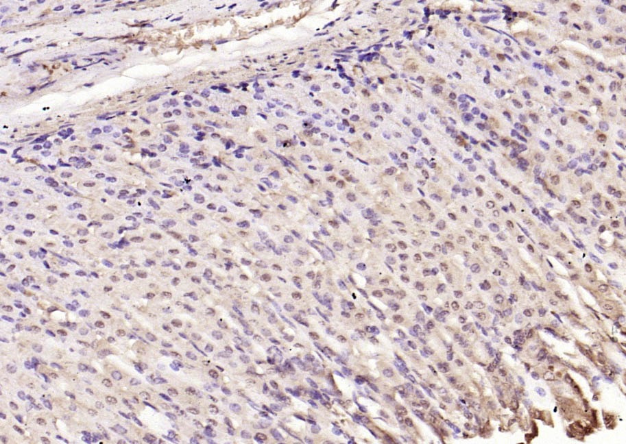 Anti-SQSTM1/P62 Polyclonal Antibody