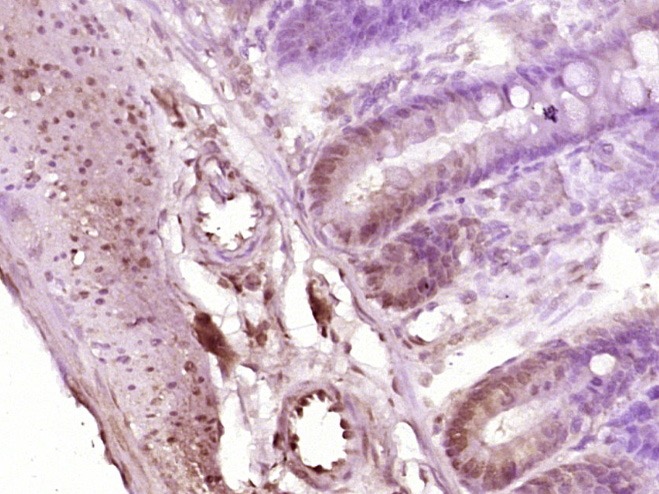 Anti-STAT1 Polyclonal Antibody 2