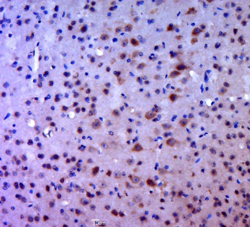 Anti-Sphingosine Kinase 1/SPHK1 Polyclonal Antibody