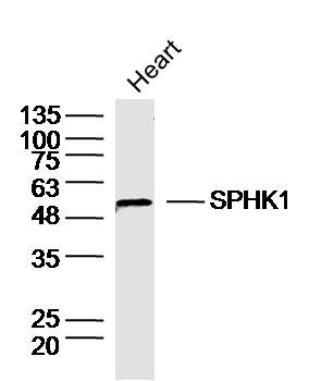 Anti-Sphingosine Kinase 1/SPHK1 Polyclonal Antibody