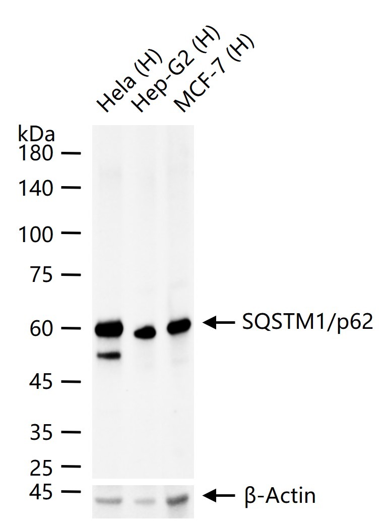 Anti-SQSTM1/p62 Antibody (9J396)