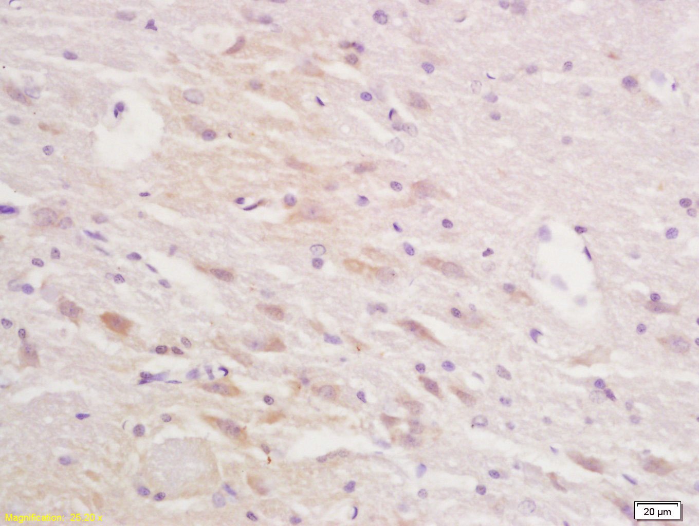 Anti-SQLE Polyclonal Antibody