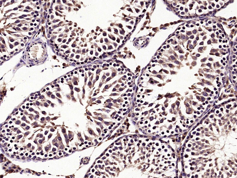 Anti-StAR Polyclonal Antibody