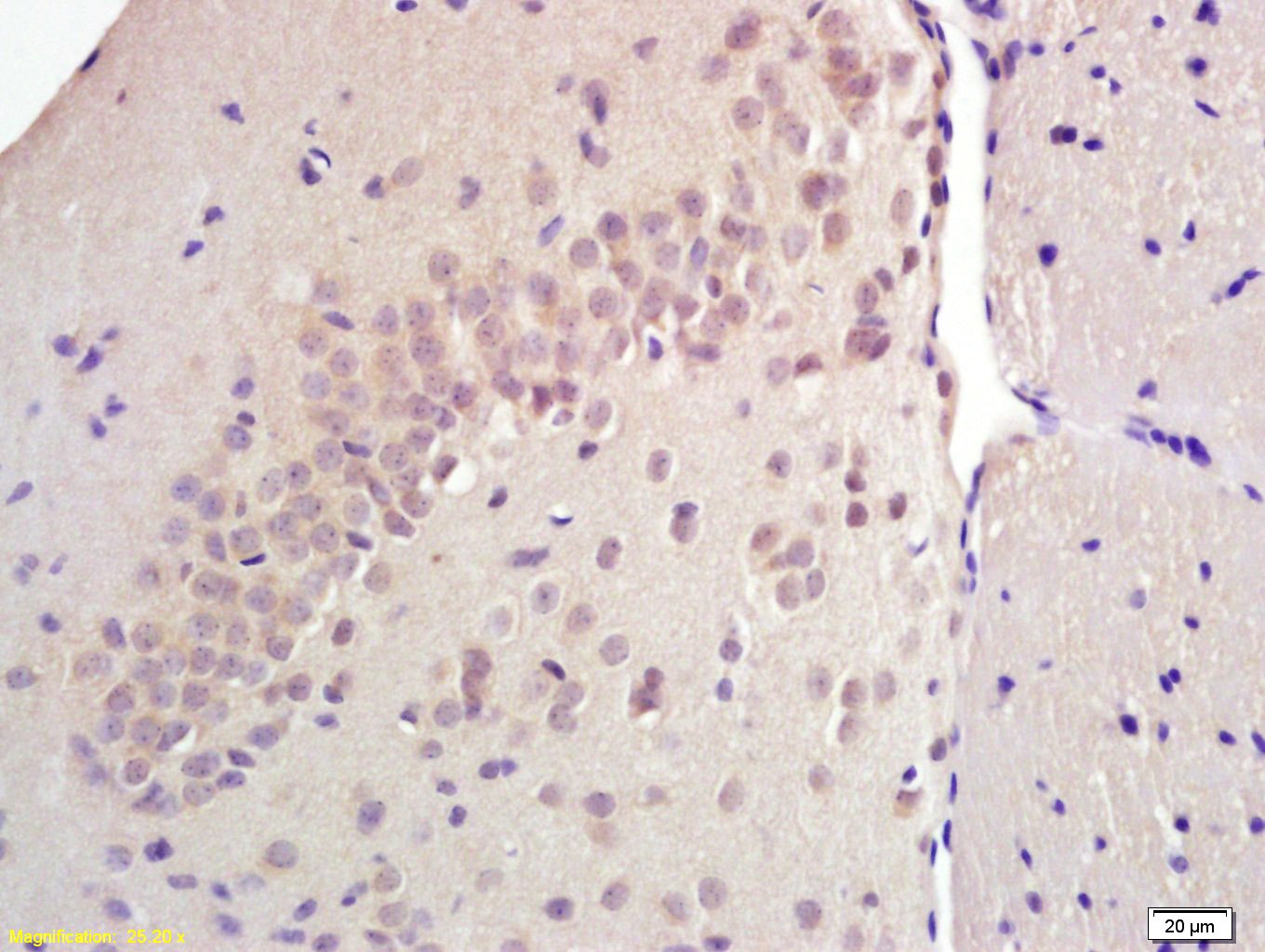 Anti-SREBP1 Polyclonal Antibody