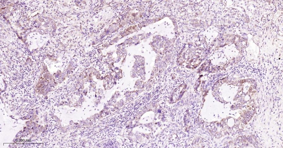 Anti-STAT3 Antibody (9V551)