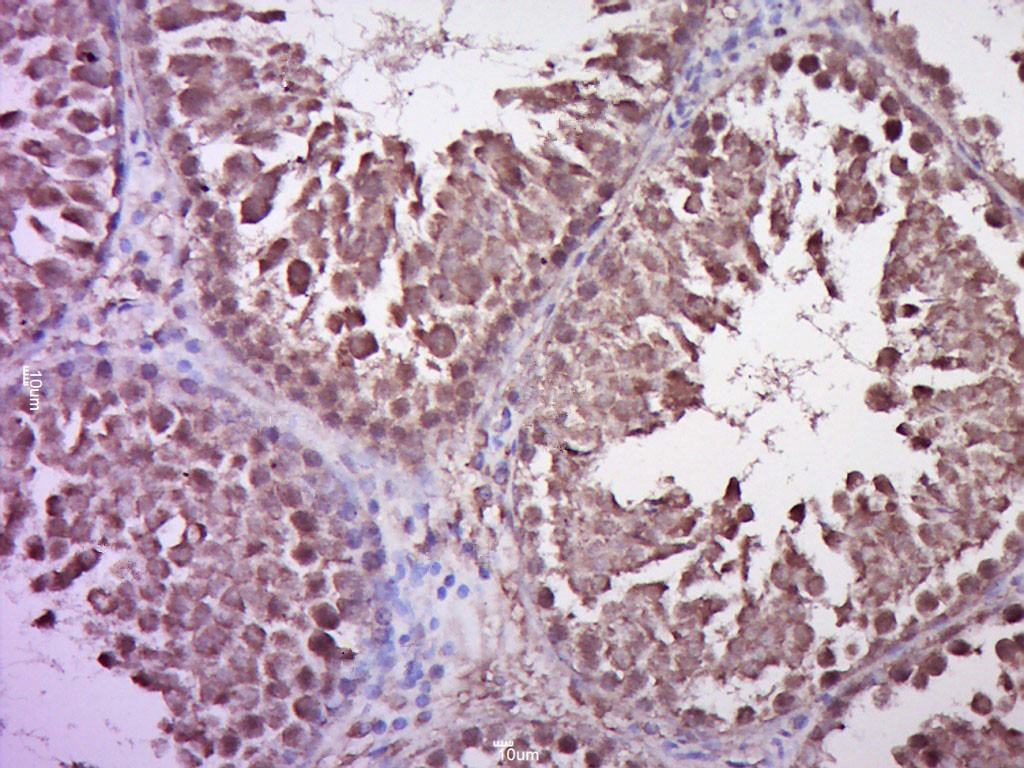 Anti-STAT1 Polyclonal Antibody